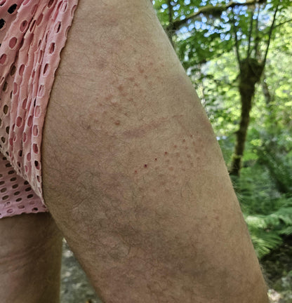 Shibari Spikes